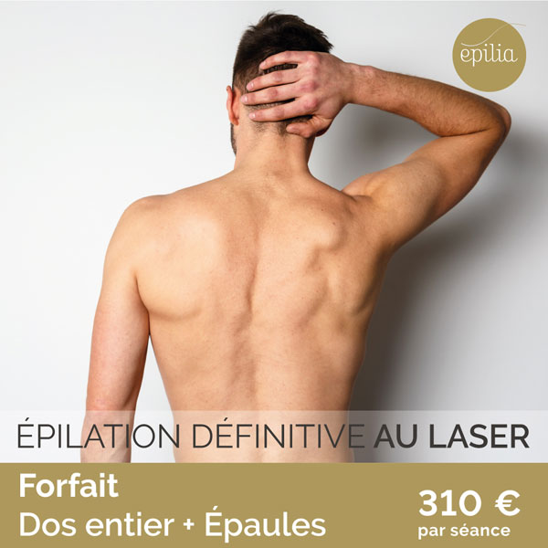 epilation-definitife-laser-forfait-homme-02.jpg