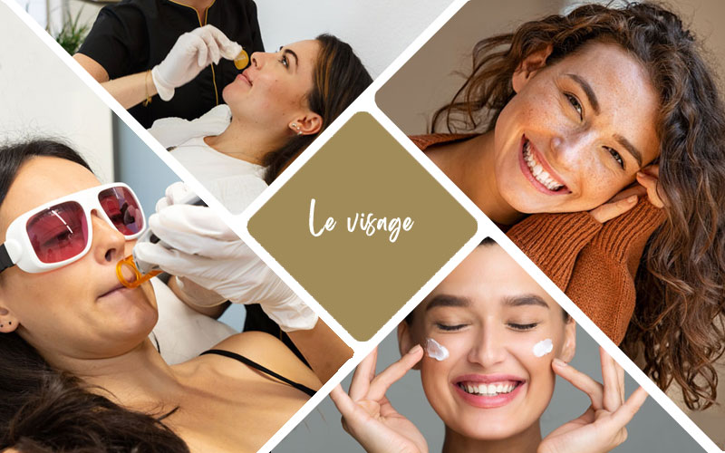 Épilation laser du visage