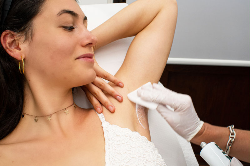 laser hair removal for underarms 6