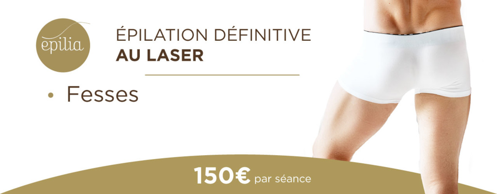 epilation-laser-fesses-homme