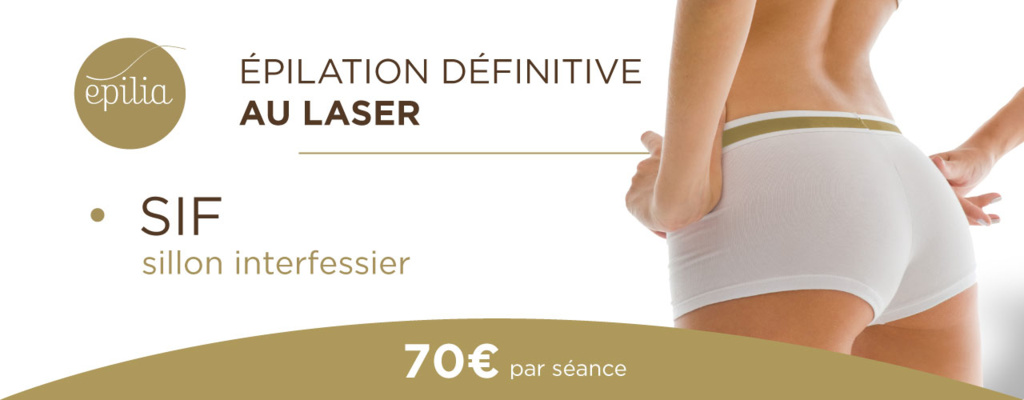 epilation-laser-sif